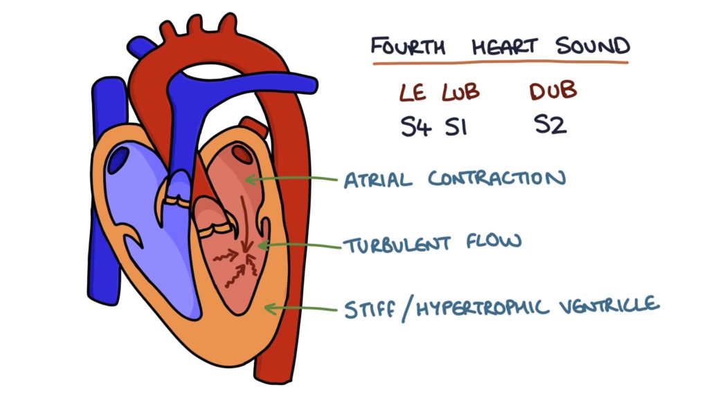 Valvular Heart Disease – Zero To Finals