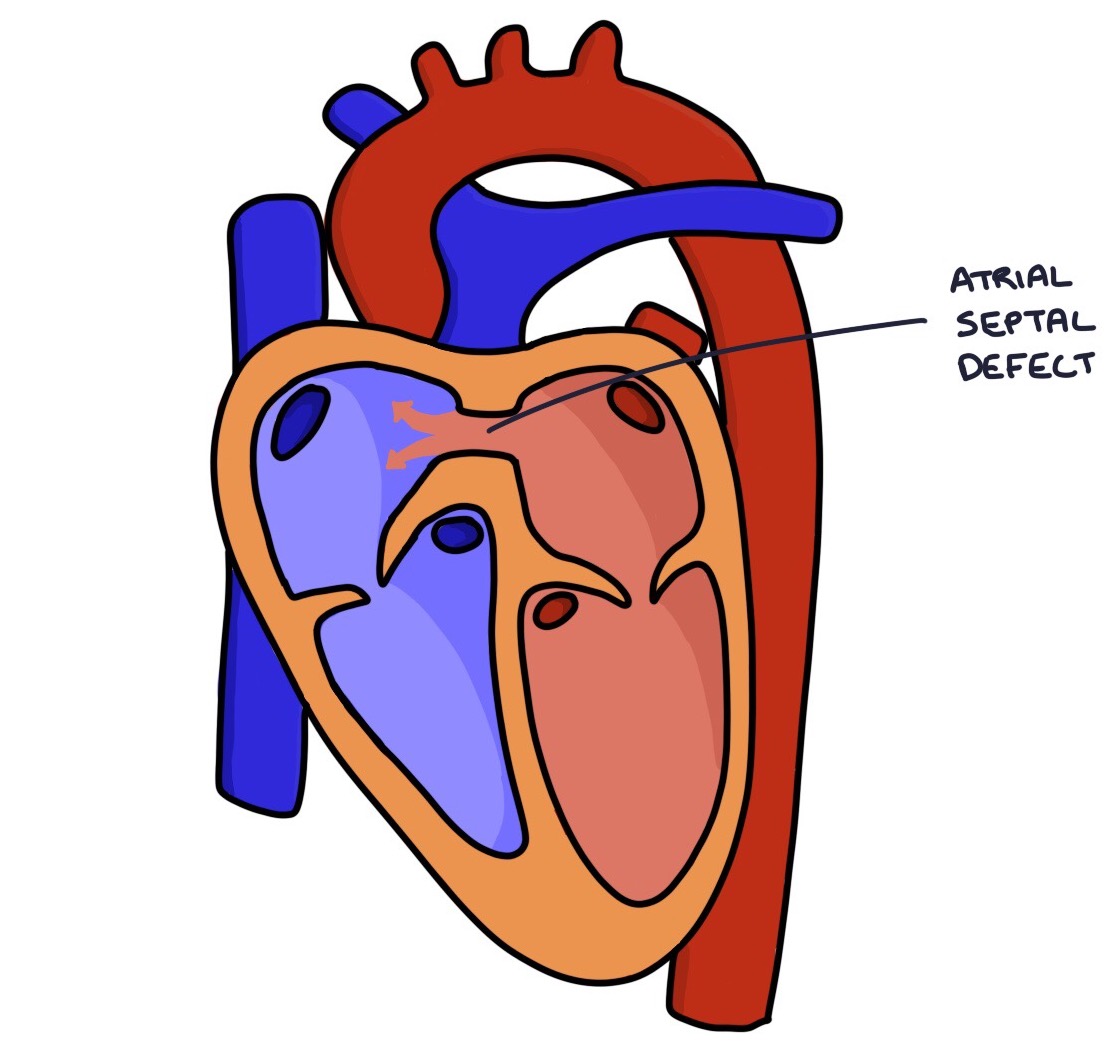 congenital-cardiac-conditions-zero-to-finals