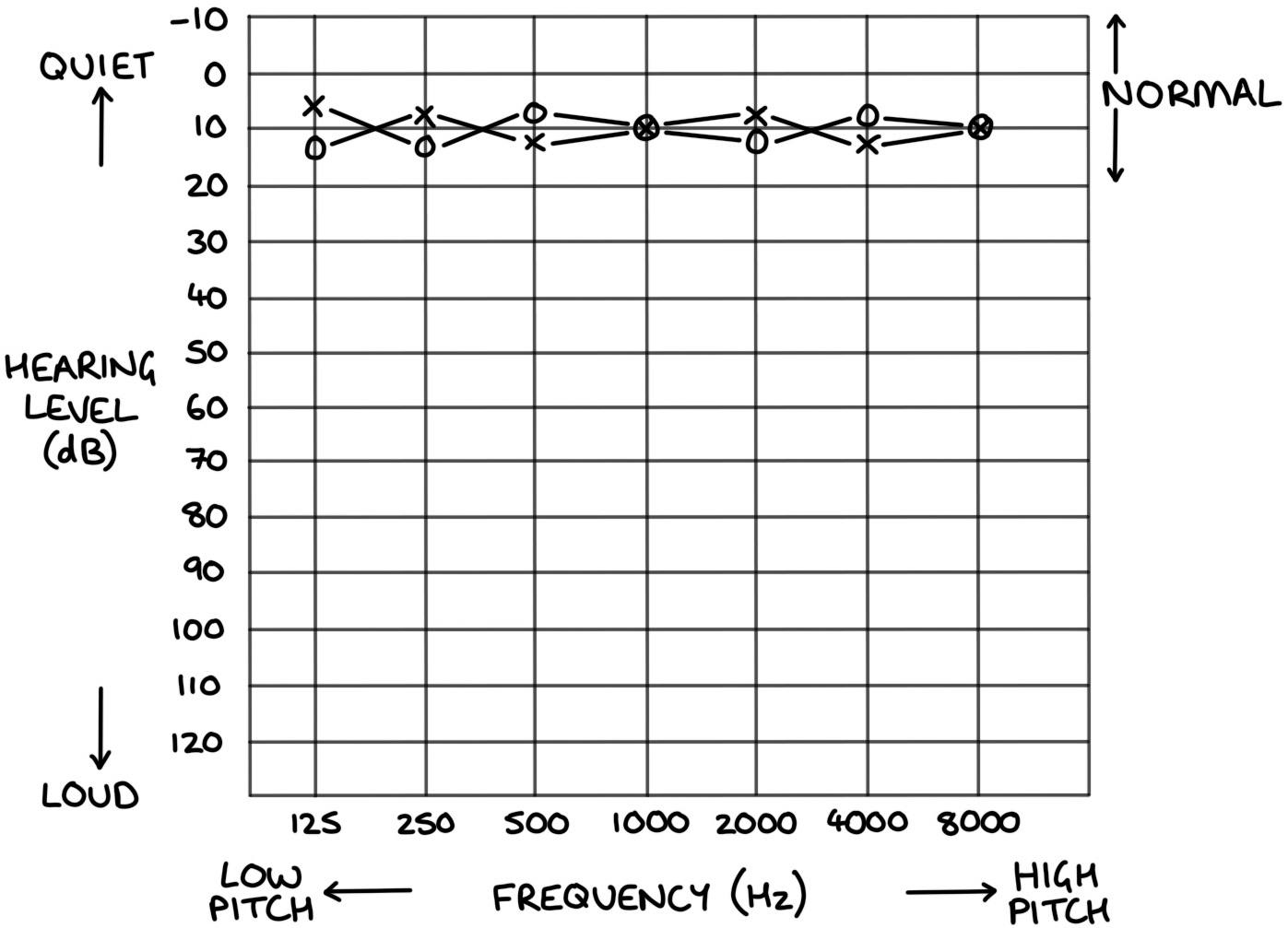 sample-blank-audiogram-qualia-audiology