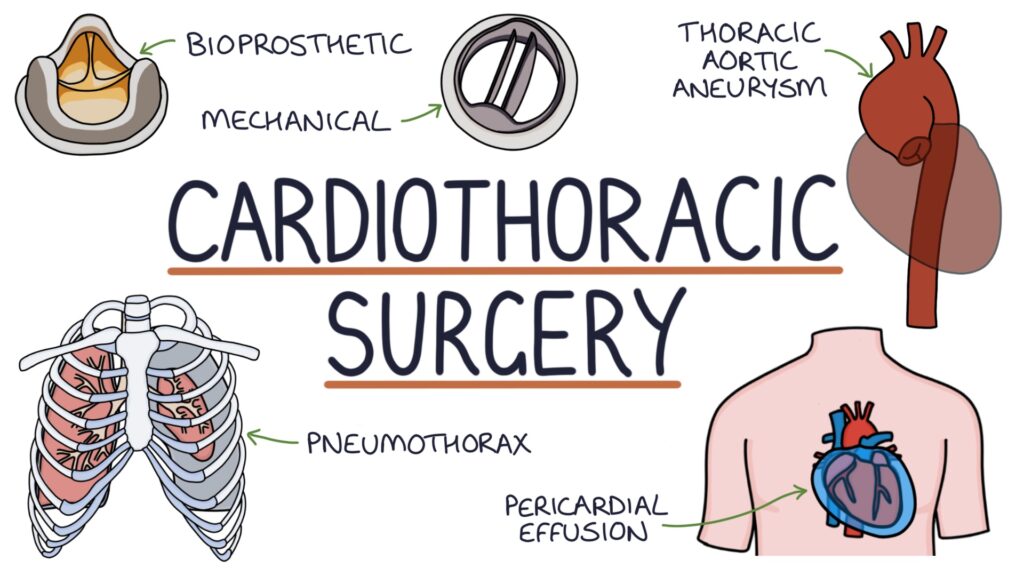Cardiothoracic Surgery Thumbnail