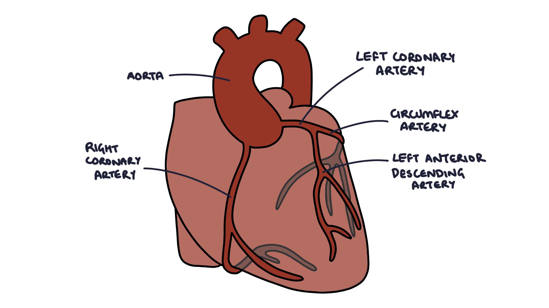 acute-coronary-syndrome-zero-to-finals