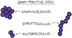 gram negative rods and gram positive cocci