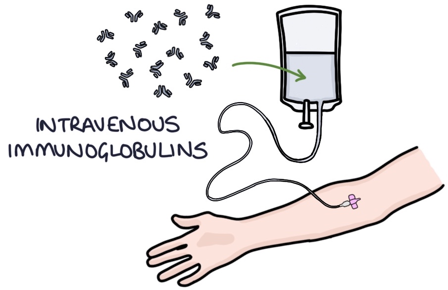 GuillainBarré Syndrome Zero To Finals