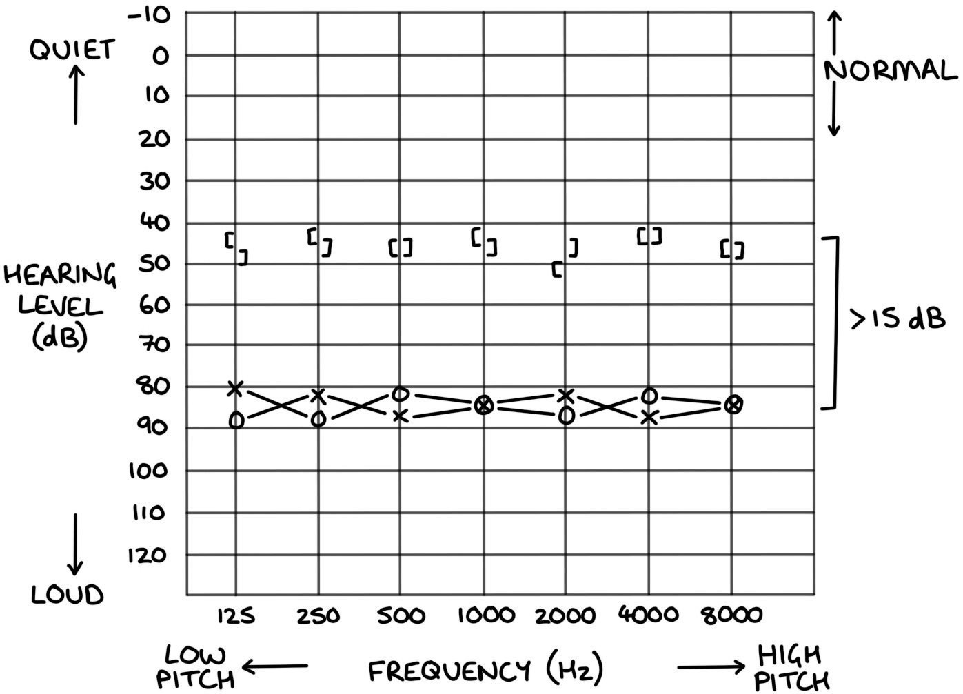 Audiometry Zero To Finals