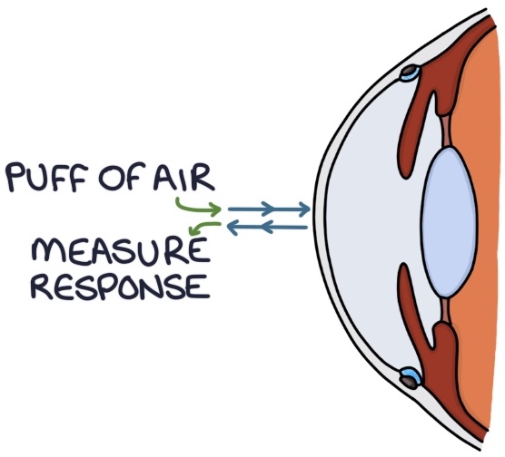 Open Angle Zero To Finals