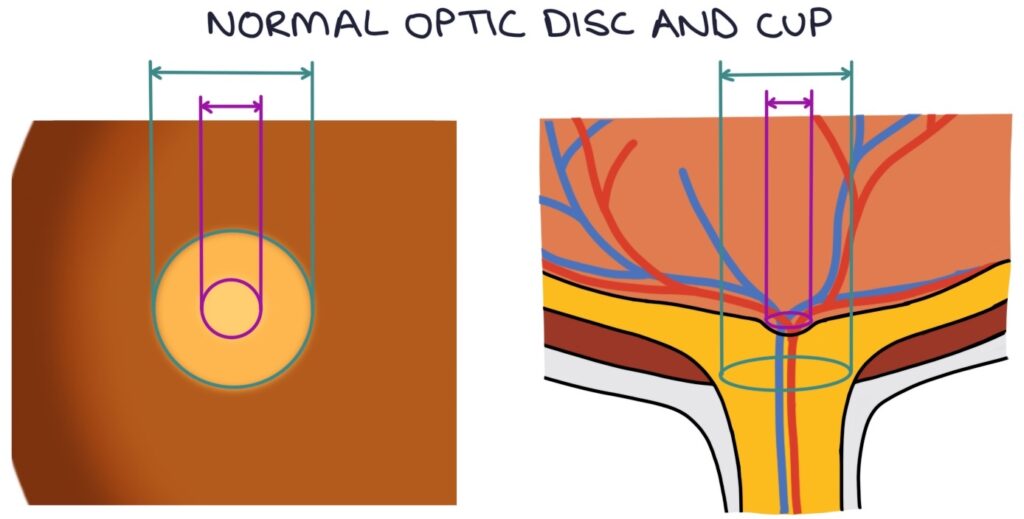 Open Angle Zero To Finals