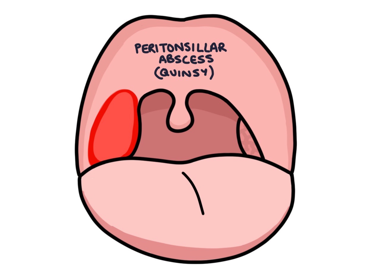 Quinsy Zero To Finals