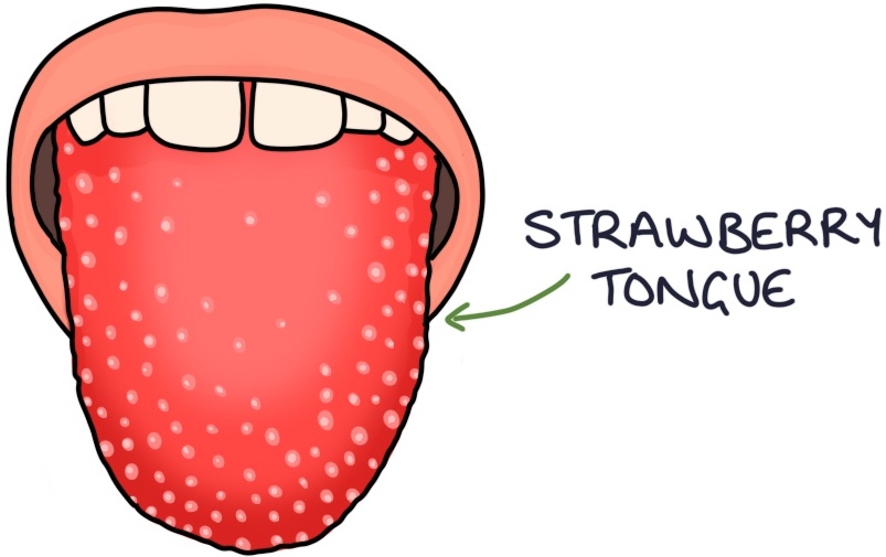 Tongue Conditions Zero To Finals
