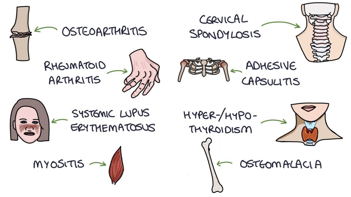 Polymyalgia Rheumatica Zero To Finals