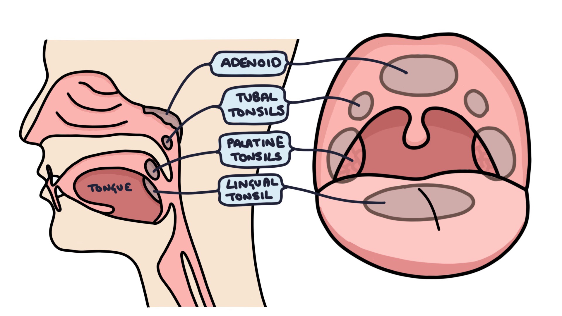 Глоточная миндалина tonsilla